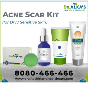 Acne scar kit for dry/sensitive skin